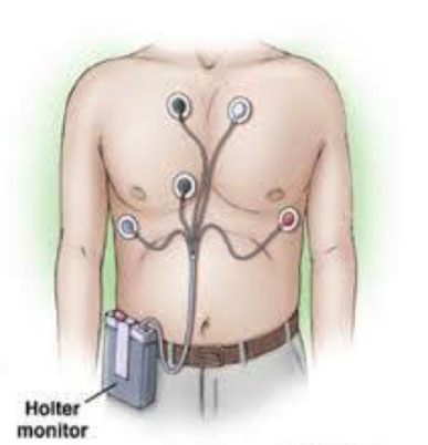 ECG Portatile 12 Derivazioni Holter Cardiaco 24 ore con Rapporto di Analisi  AI