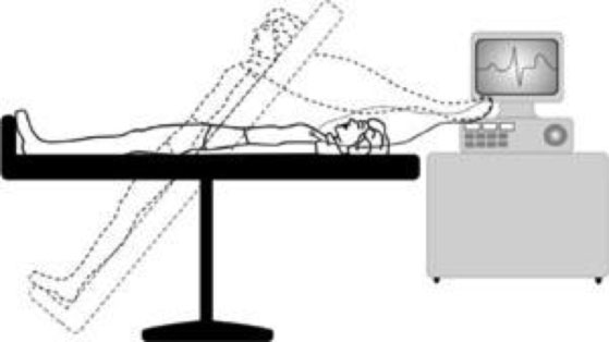 Canberra Heart Rhythm Centre - Tilt testing