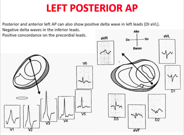 AP posteriore sinistro