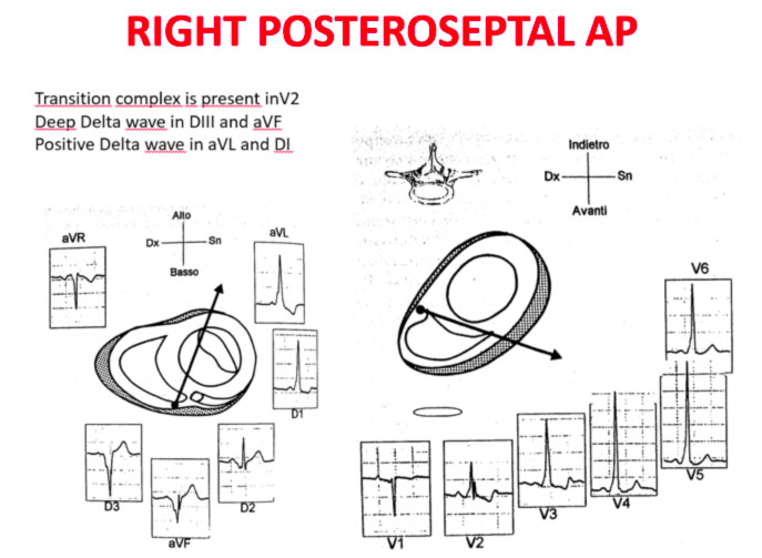 AP postero-settale destro